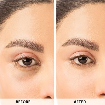 Anua retinol cream - Reduce Wrinkle, fine lines & Hyperpigmentation - Guaranteed Results